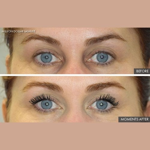 Million Dollar Lash Kit